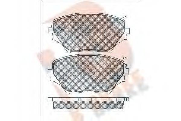 R BRAKE RB1519