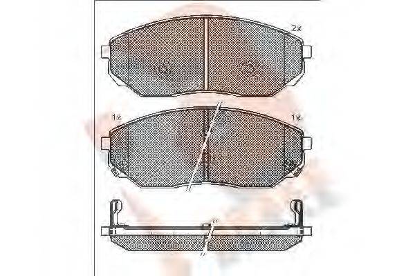 R BRAKE RB1606