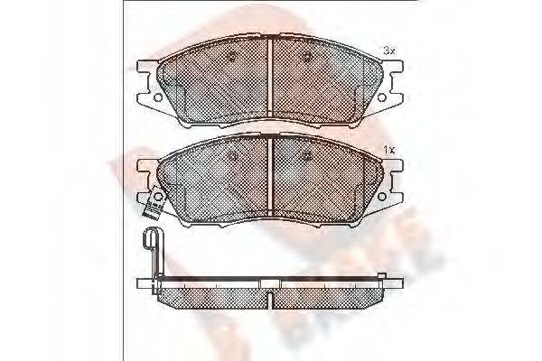 R BRAKE RB1635