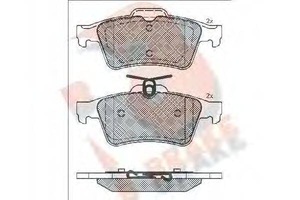 R BRAKE RB1651-200