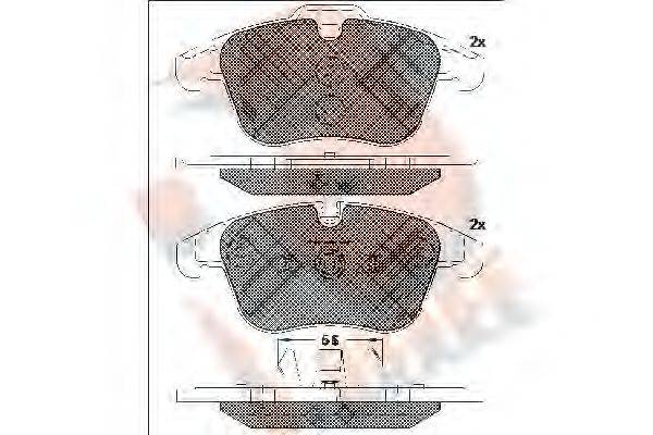 R BRAKE RB1775-203