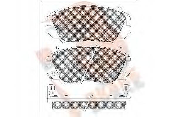 R BRAKE RB1914